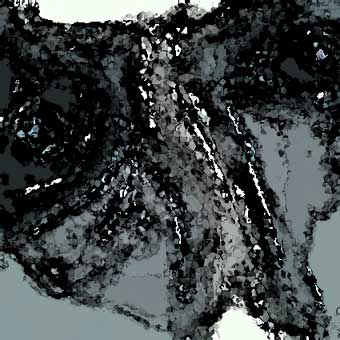 sick007.jpg (25846 �ֽ�)